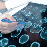 Doctor examines the patient tomography