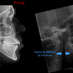 Slide27