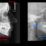 Slide56 – Copia